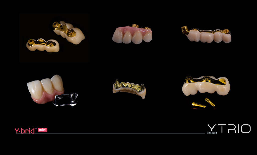 Hibrid mini