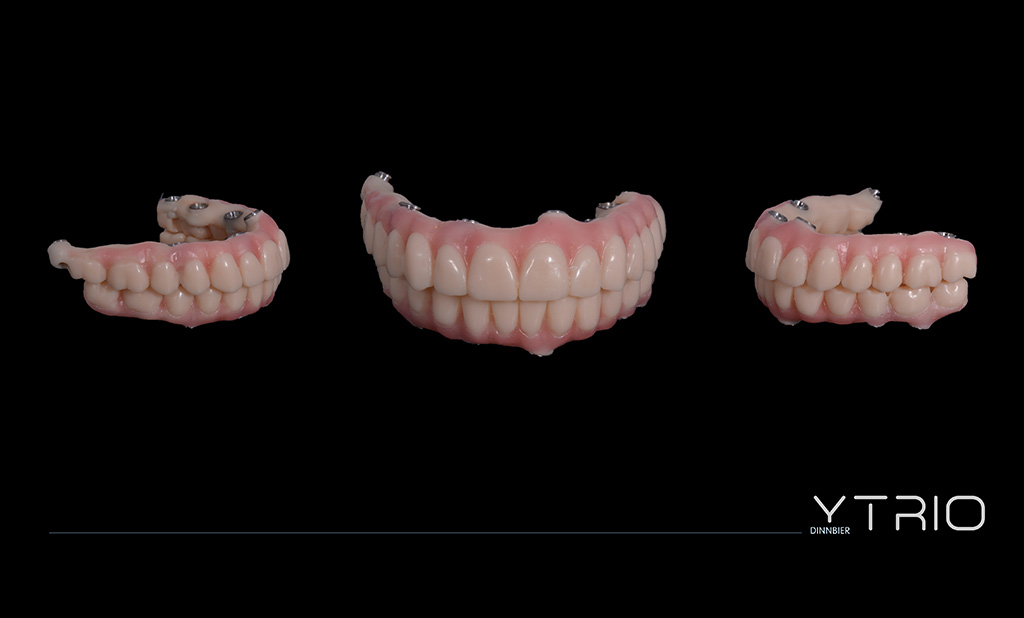 Hibrid