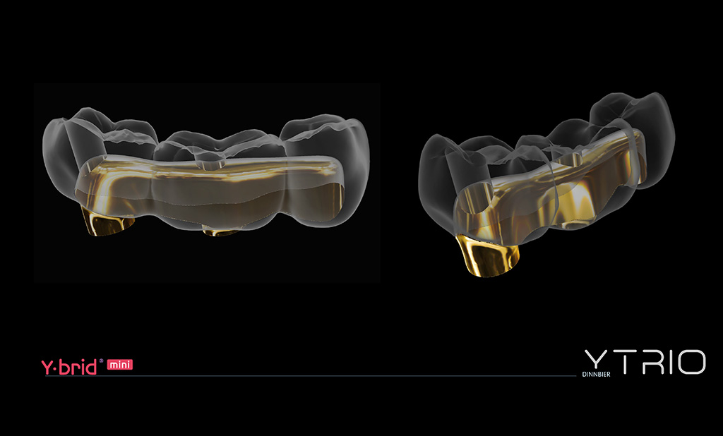 Hibrid mini